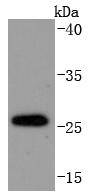 DDIT3 Rabbit mAb