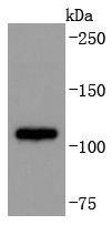 ADAM17 Rabbit mAb