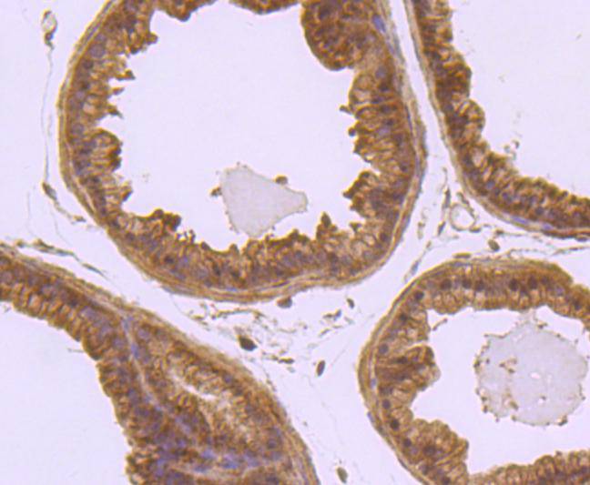 Laminin beta 1 Rabbit mAb