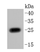 PGP9.5 Rabbit mAb