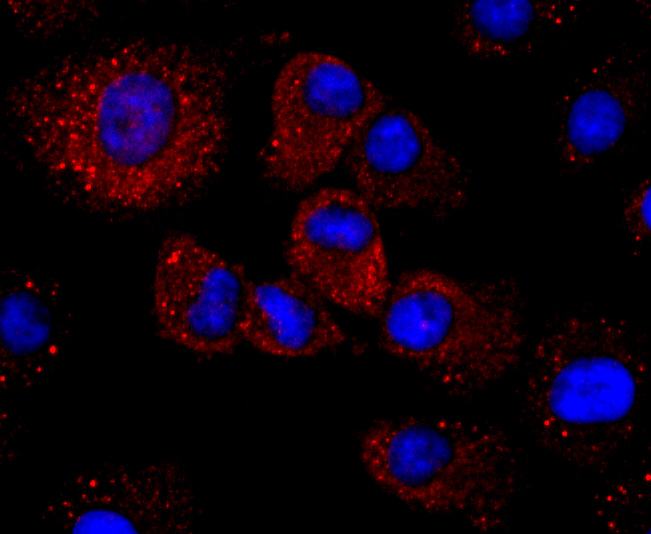 Haptoglobin Rabbit mAb