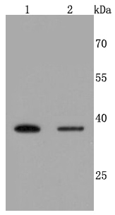 Haptoglobin Rabbit mAb