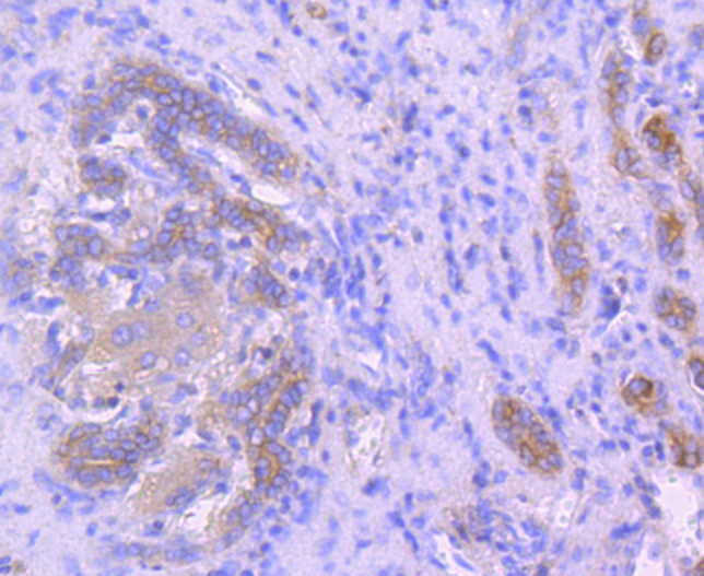 Ezrin Rabbit mAb