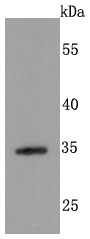 Syndecan 1 Rabbit mAb