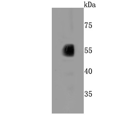 CYP2E1 Rabbit mAb