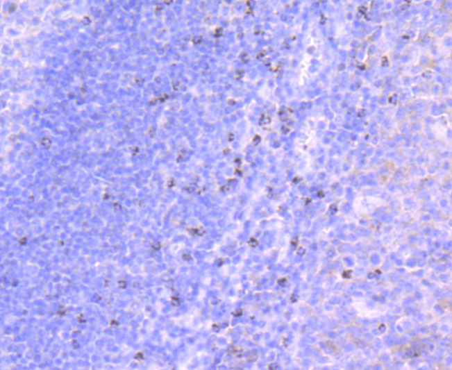 TIA1 Rabbit mAb