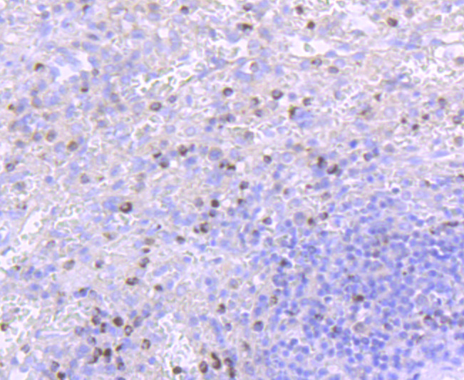 TIA1 Rabbit mAb