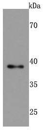TIA1 Rabbit mAb