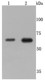 TNF Receptor II Rabbit mAb