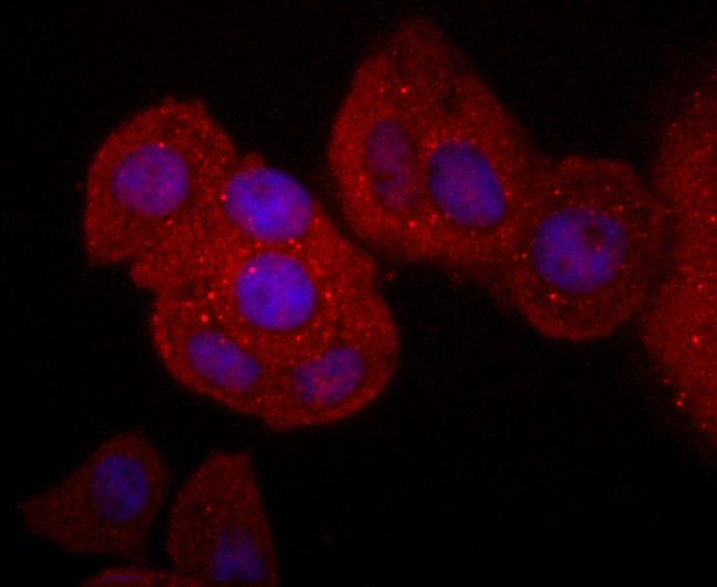 CD40L Rabbit mAb
