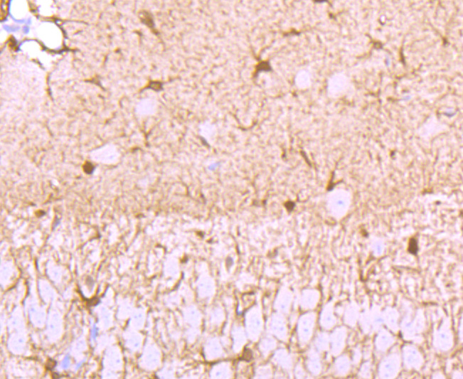 S100 Rabbit mAb