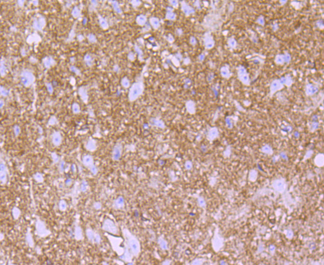 S100 Rabbit mAb