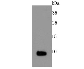 S100 Rabbit mAb