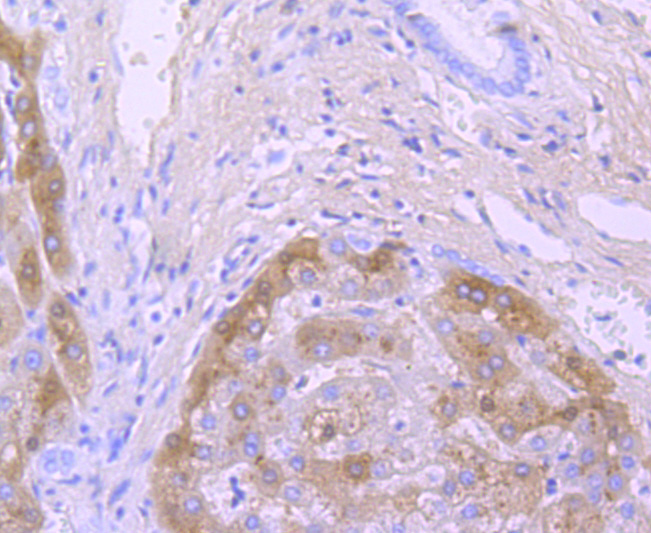 TTR Rabbit mAb