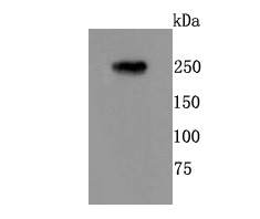 mGluR1 Rabbit mAb