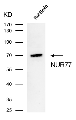 NUR77 Rabbit mAb