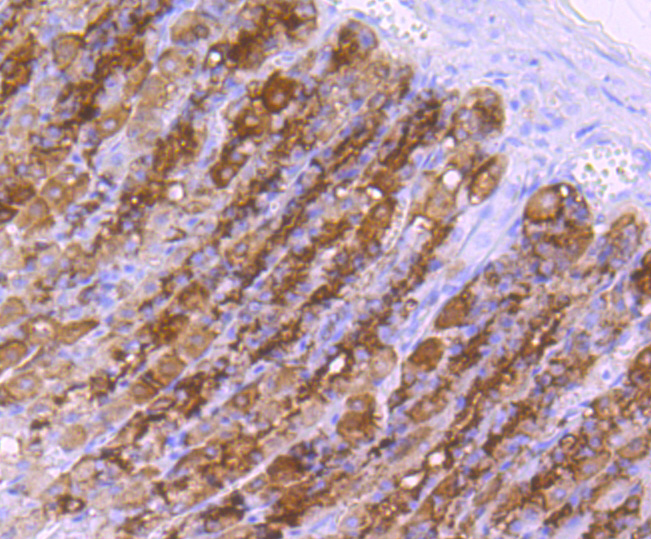 Choline Acetyltransferase Rabbit mAb