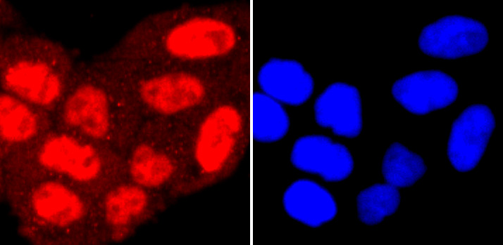 PRMT1 Rabbit mAb