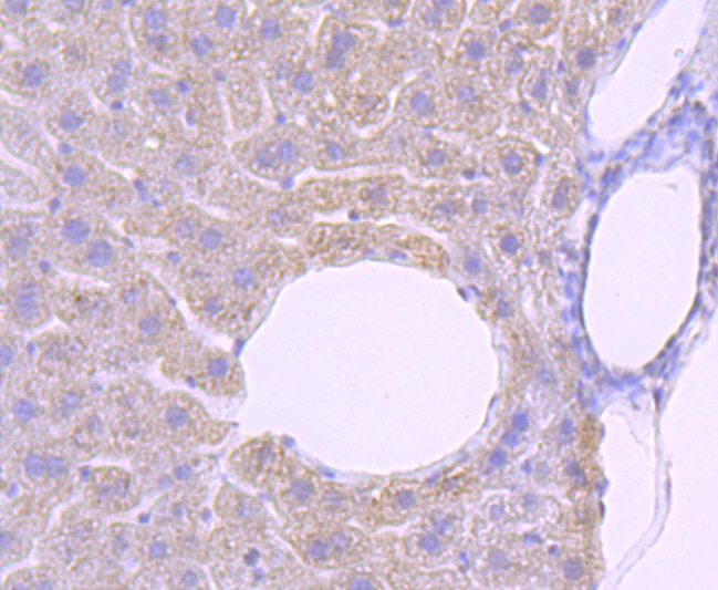 PRMT1 Rabbit mAb