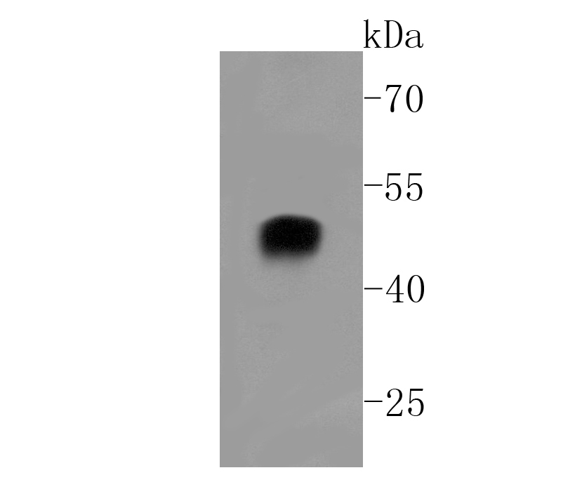 alpha sarcoglycan Rabbit mAb