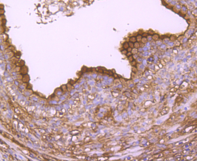 Annexin A2 Rabbit mAb