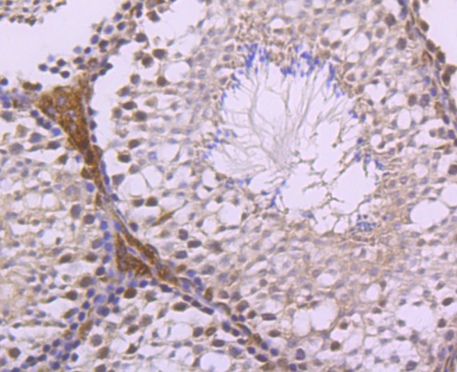LXR alpha Rabbit mAb