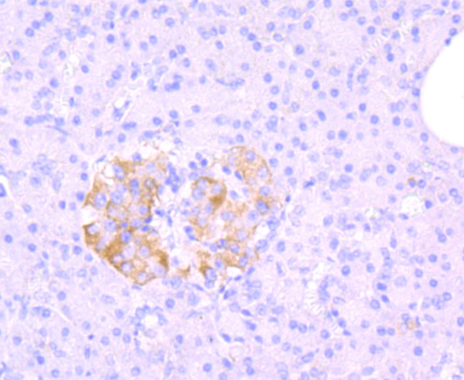MRP1 Rabbit mAb