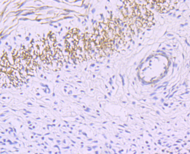 smooth muscle Myosin heavy chain 11 Rabbit mAb