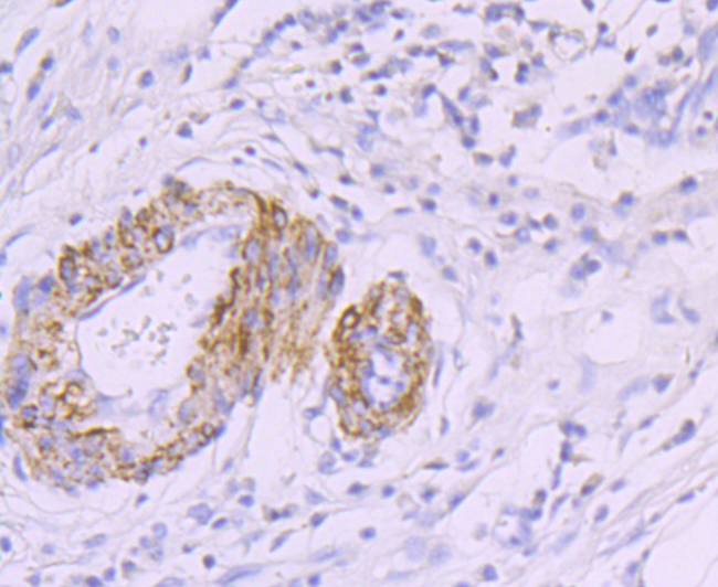 smooth muscle Myosin heavy chain 11 Rabbit mAb