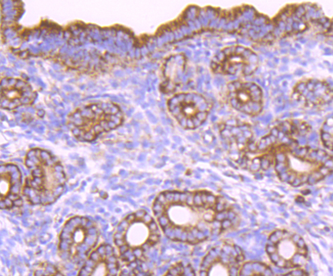 CD39 Rabbit mAb