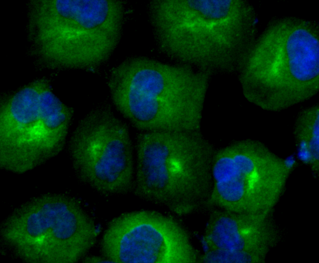 TXNRD1 Rabbit mAb