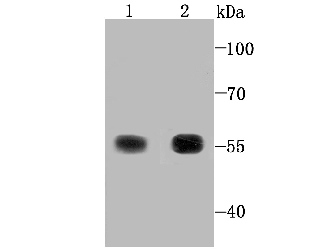 TXNRD1 Rabbit mAb