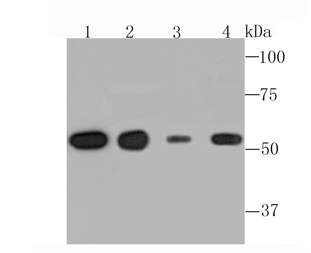 alpha Tubulin 4A Rabbit mAb