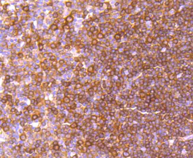 c-Rel Rabbit mAb