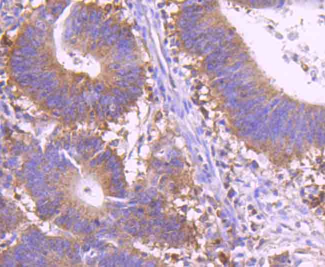 c-Rel Rabbit mAb