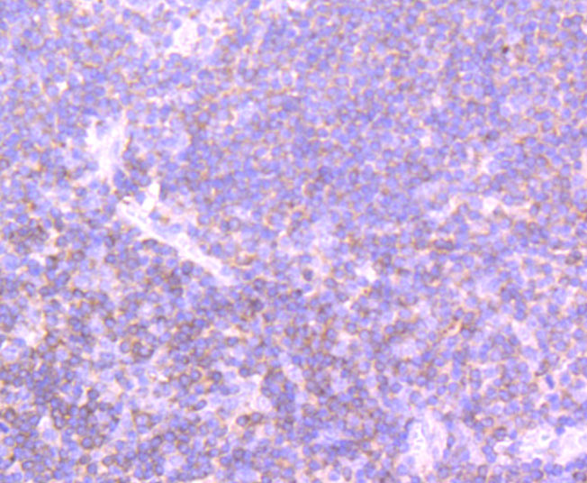 PI 3 Kinase p110 delta Rabbit mAb