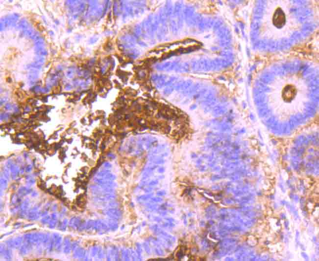 Carcino Embryonic Antigen CEA Rabbit mAb