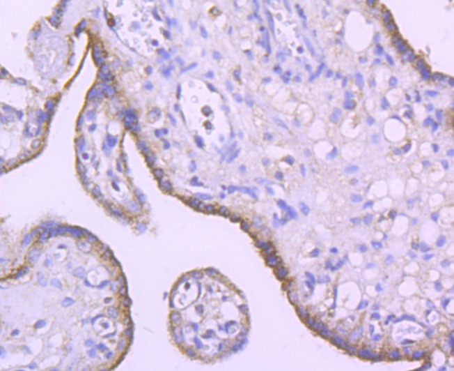 SMYD3 Rabbit mAb