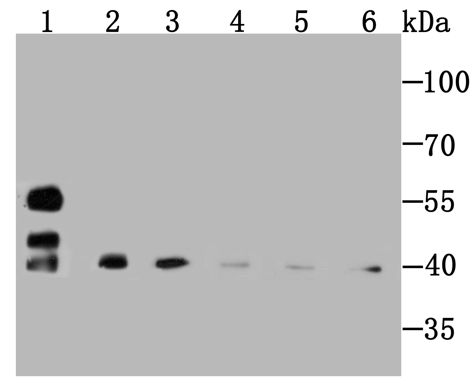 SMYD3 Rabbit mAb