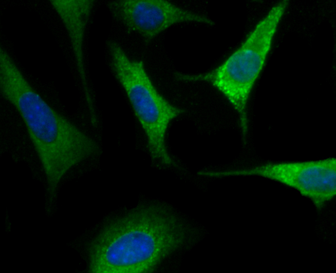 Nogo B Rabbit mAb