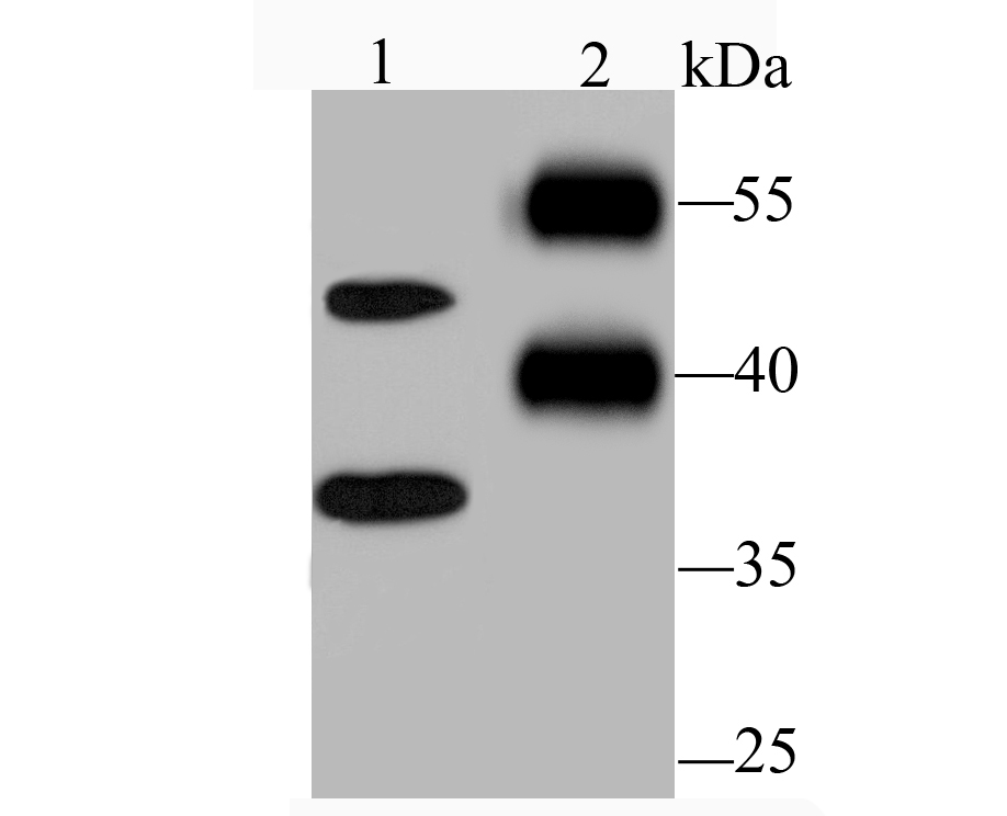 Nogo B Rabbit mAb