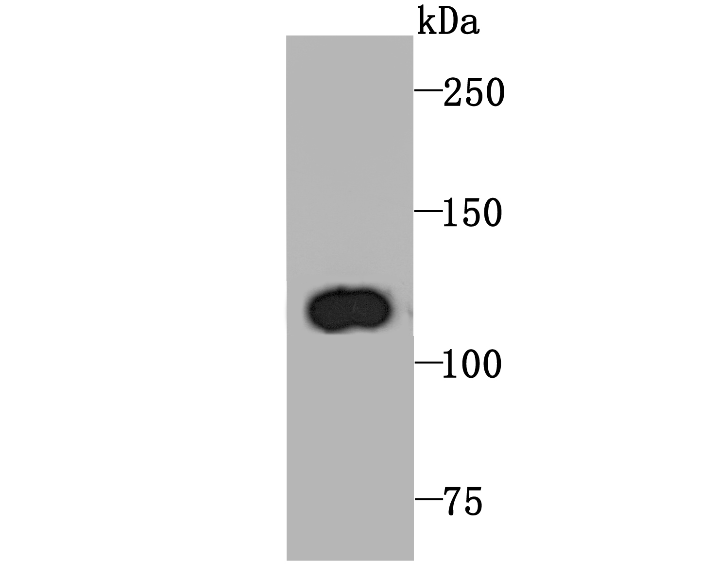 PGC1 beta Rabbit mAb