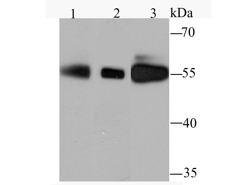 PFKFB3 Rabbit mAb