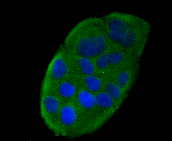 RANTES Rabbit mAb