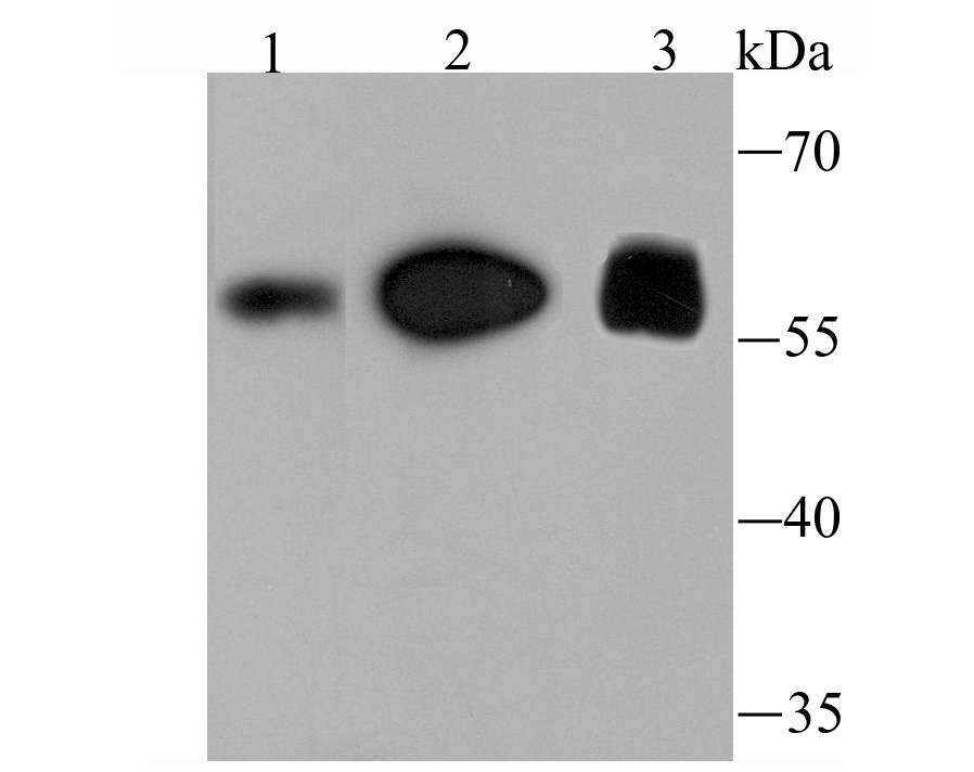 FTO Rabbit mAb