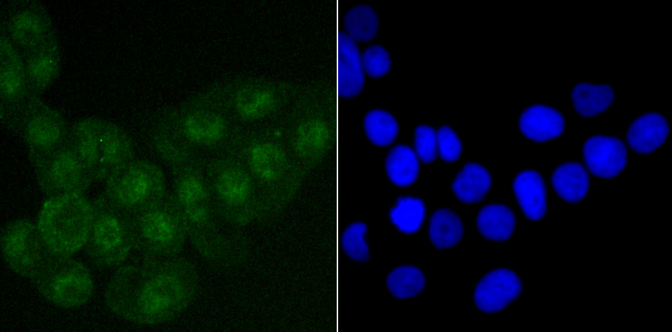 SATB2 Rabbit mAb