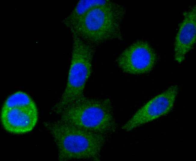 NDUFS3 Rabbit mAb