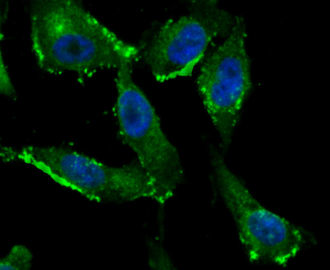 Fragilis Rabbit mAb