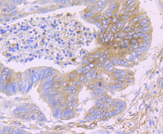 Fragilis Rabbit mAb