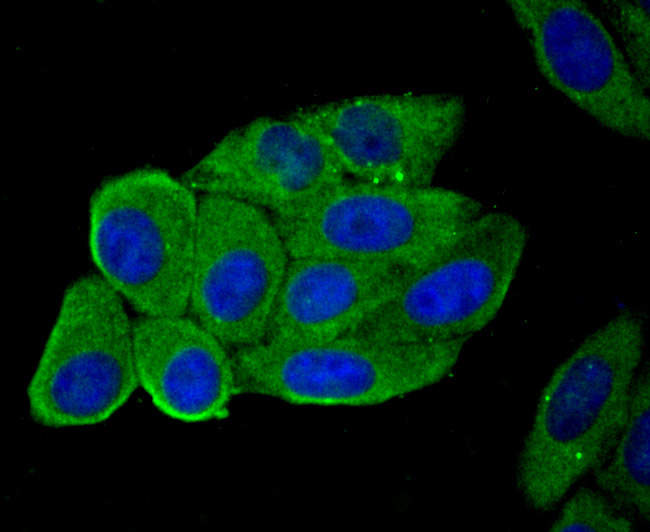 Hemopexin Rabbit mAb